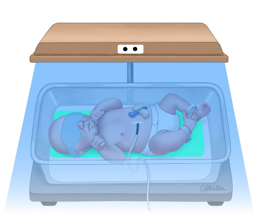 Hospitalphototherapy-