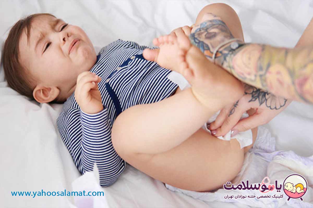 تنگی مجرای ادرار چیست؟