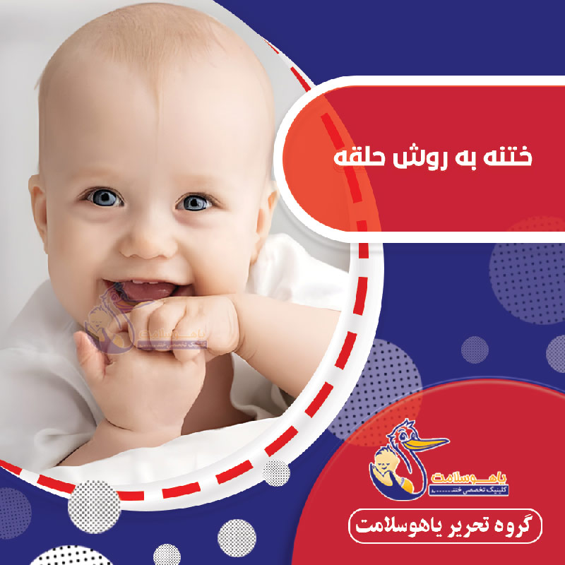 ختنه به روش حلقه