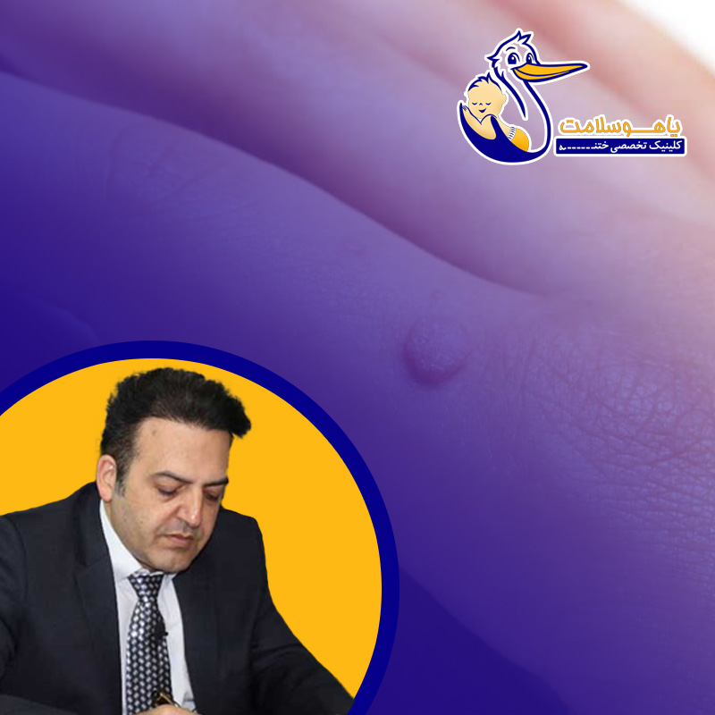 برگشت زگیل
