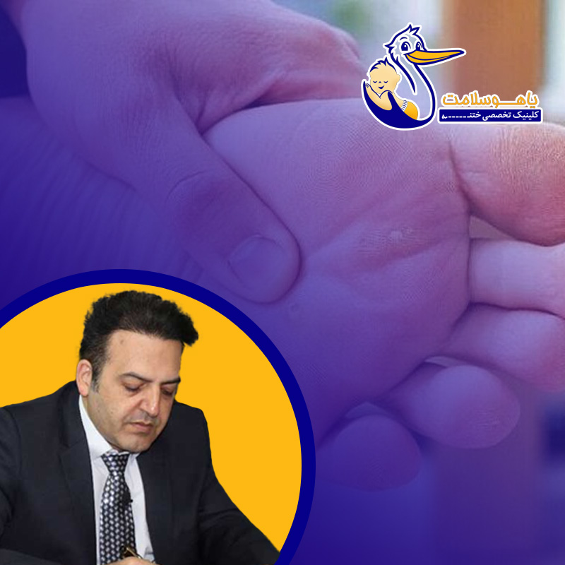تفاوت میخچه و زگیل