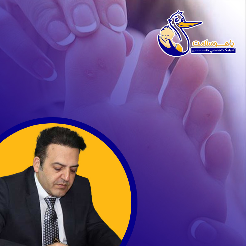 درمان میخچه پا
