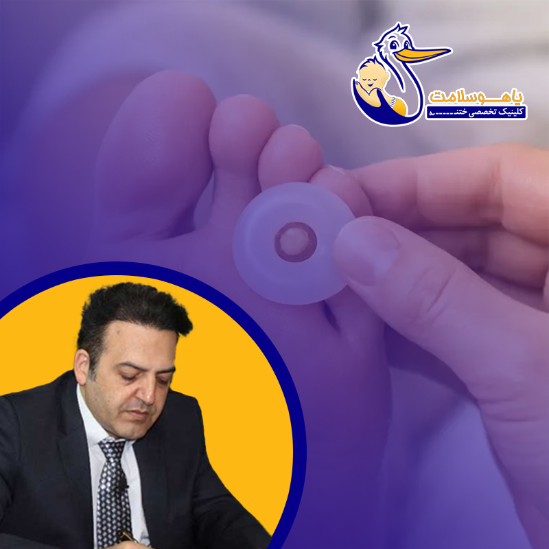 -آیا-چسب-میخچه-واقعاً-مؤثر-است؟