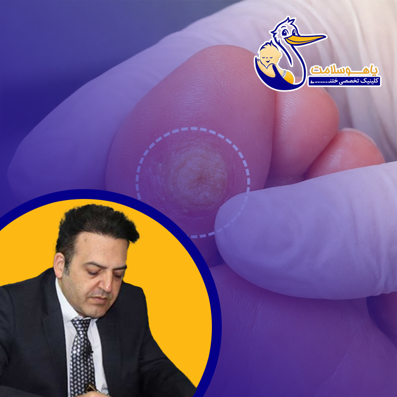 درمان-فوری-میخچه-دردناک؛-چه-زمانی-باید-مراجعه-کرد؟