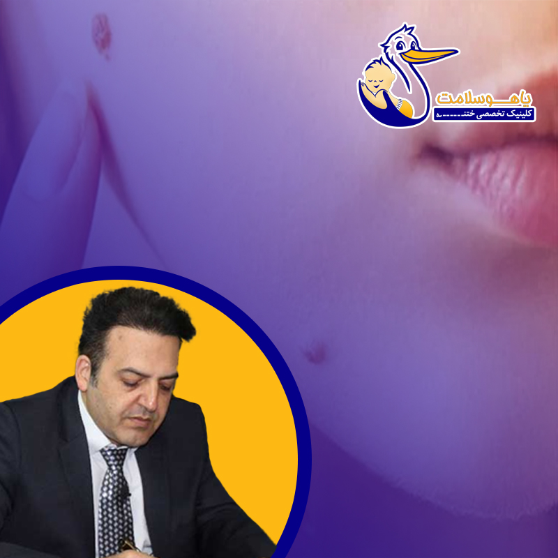درمان-زگیل-صورت؛-کدام-روش-درمان-کم‌-عارضه‌-تر-است؟