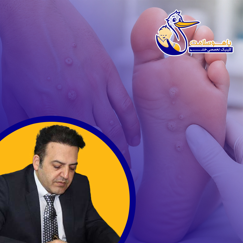 زگیل‌های-متعدد؛-چه-زمانی-نیاز-به-بررسی-تخصصی-دارند؟