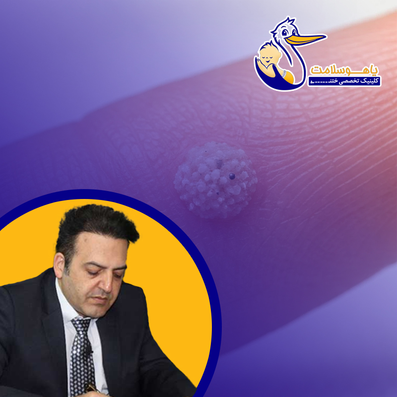 چرا-زگیل-بعد-از-درمان-دوباره-برمی‌گردد؟-بررسی-علمی-برگشت-زگیل
